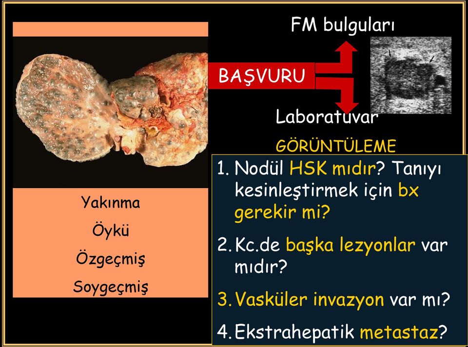 Tanıyı kesinleştirmek için bx gerekir mi? 2.Kc.