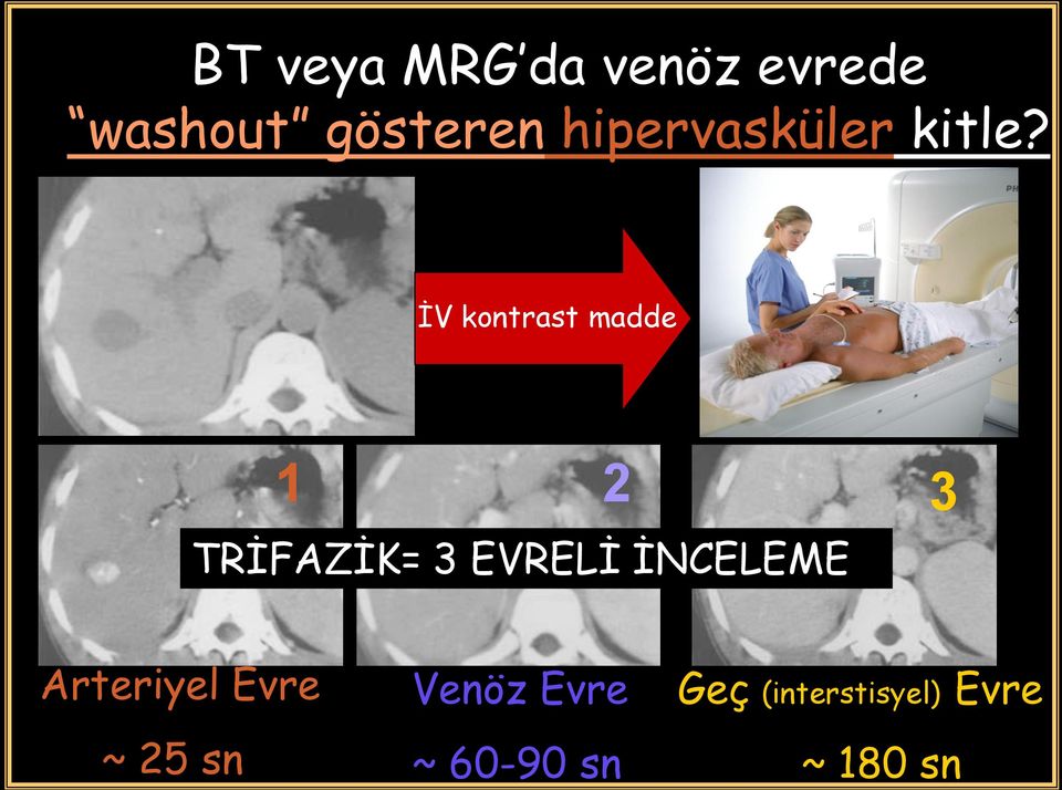 İV kontrast madde 1 2 3 TRİFAZİK= 3 EVRELİ