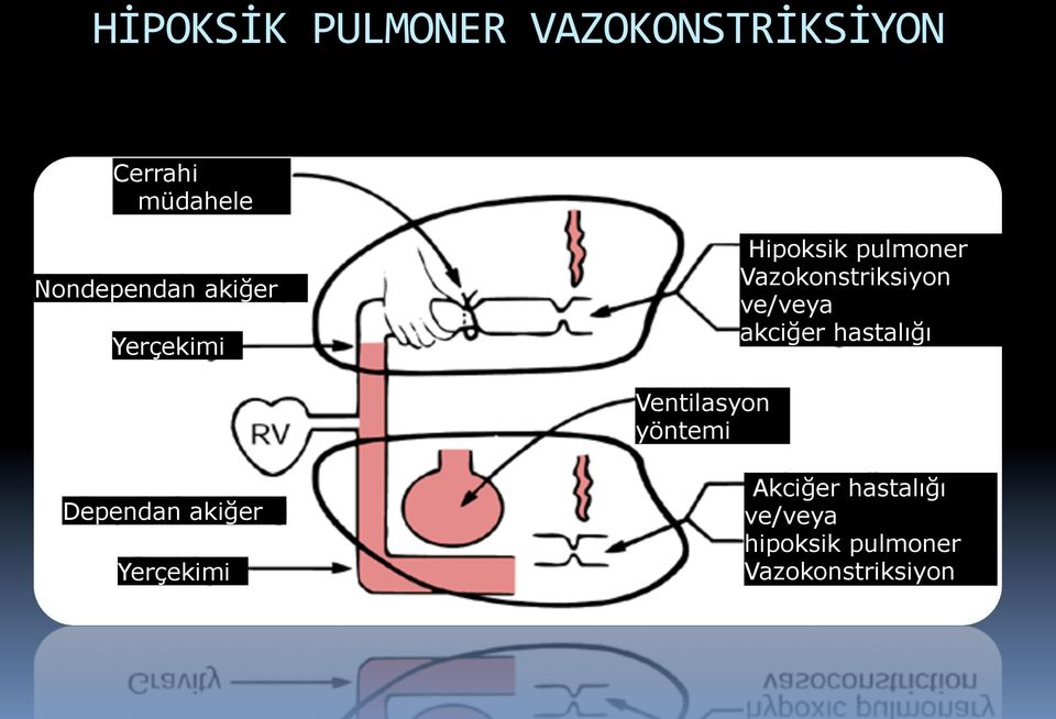 Vazokonstriksiyon ve/veya akciğer hastalığı Ventilasyon