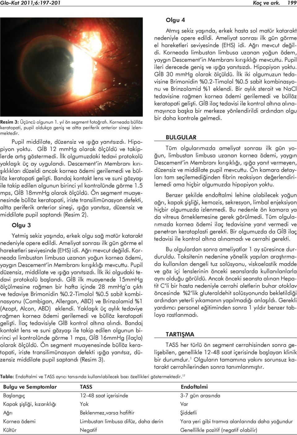 Descement in Membranı kırışıklıkları düzeldi ancak kornea ödemi gerilemedi ve büllöz keratopati gelişti. Bandaj kontakt lens ve suni gözyaşı ile takip edilen olgunun birinci yıl kontrolünde görme 1.