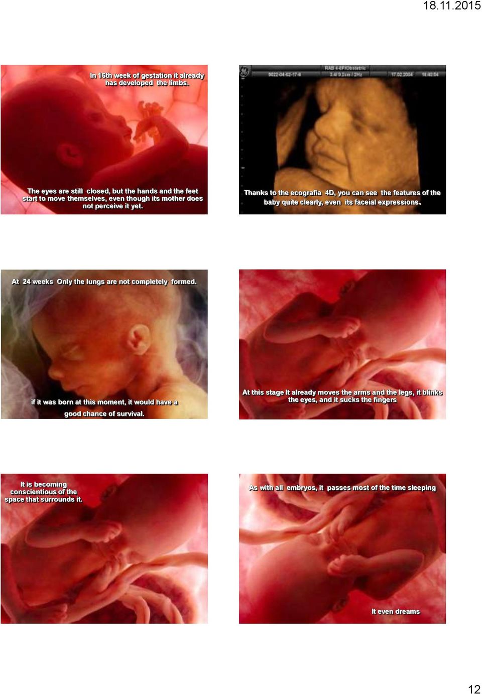 Thanks to the ecografia 4D, you can see the features of the baby quite clearly, even its faceial expressions. At 24 weeks Only the lungs are not completely formed.