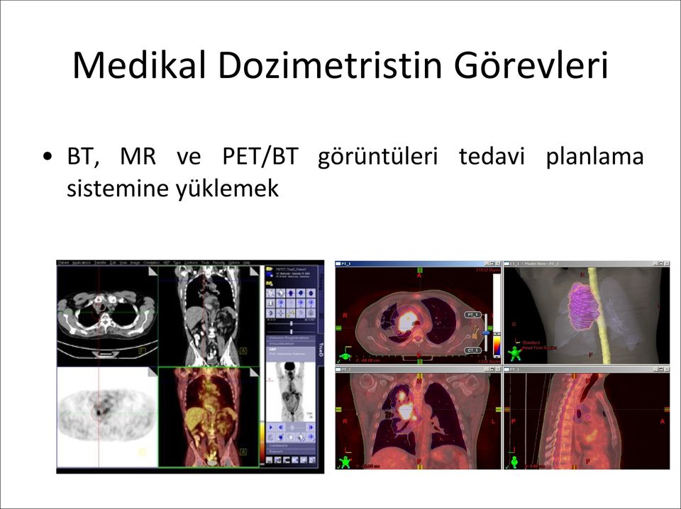 PET/BT görüntüleri