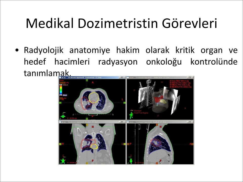 kritik organ ve hedef hacimleri