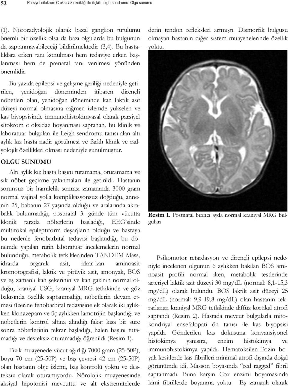 Bu hastalıklara erken tanı konulması hem tedaviye erken başlanması hem de prenatal tanı verilmesi yönünden önemlidir. derin tendon refleksleri artmıştı.