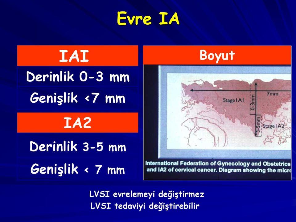 Genişlik < 7 mm LVSI evrelemeyi