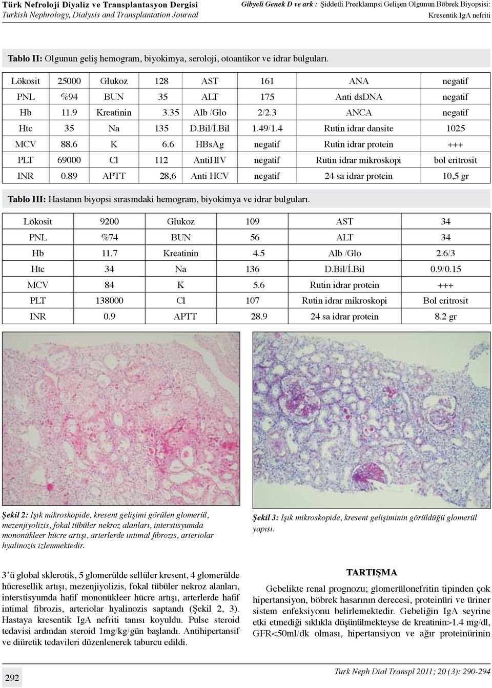 6 HBsAg negatif Rutin idrar protein +++ PLT 69000 Cl 112 AntiHIV negatif Rutin idrar mikroskopi bol eritrosit INR 0.