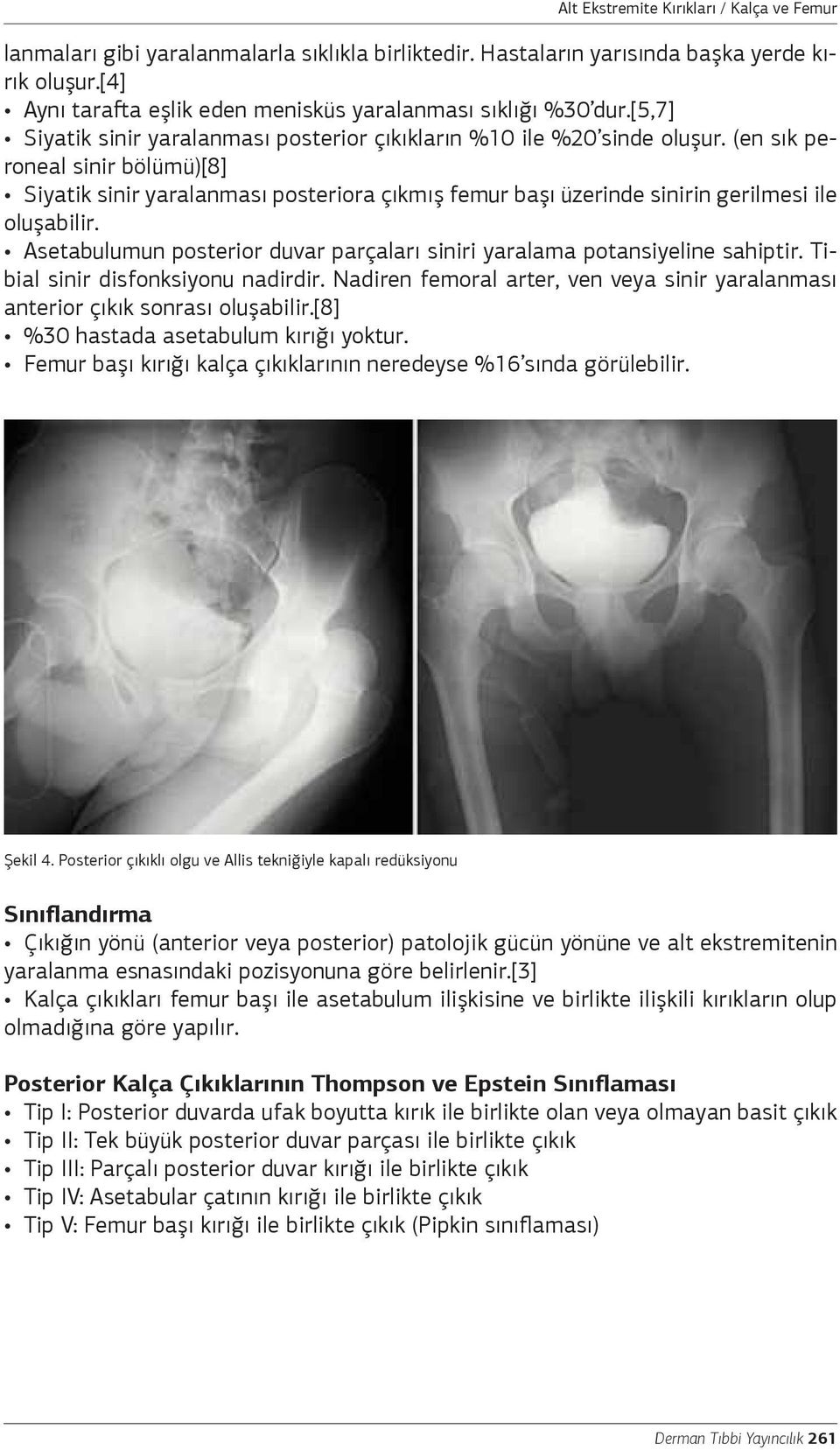 (en sık peroneal sinir bölümü)[8] Siyatik sinir yaralanması posteriora çıkmış femur başı üzerinde sinirin gerilmesi ile oluşabilir.