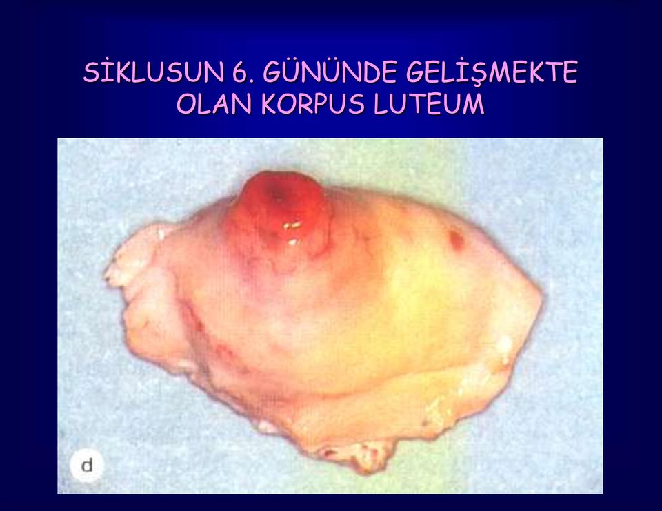 GELİŞMEKTE