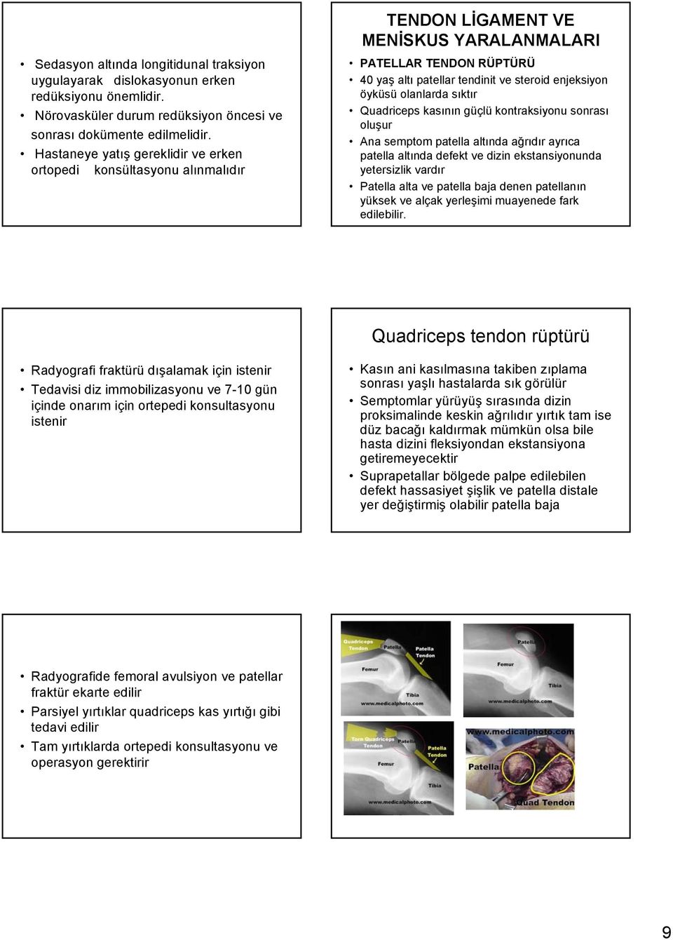 Hastaneye yatış gereklidir ve erken ortopedi konsültasyonu alınmalıdır PATELLAR TENDON RÜPTÜRÜ 40 yaş altı patellar tendinit ve steroid enjeksiyon öyküsü olanlarda sıktır Quadriceps kasının güçlü