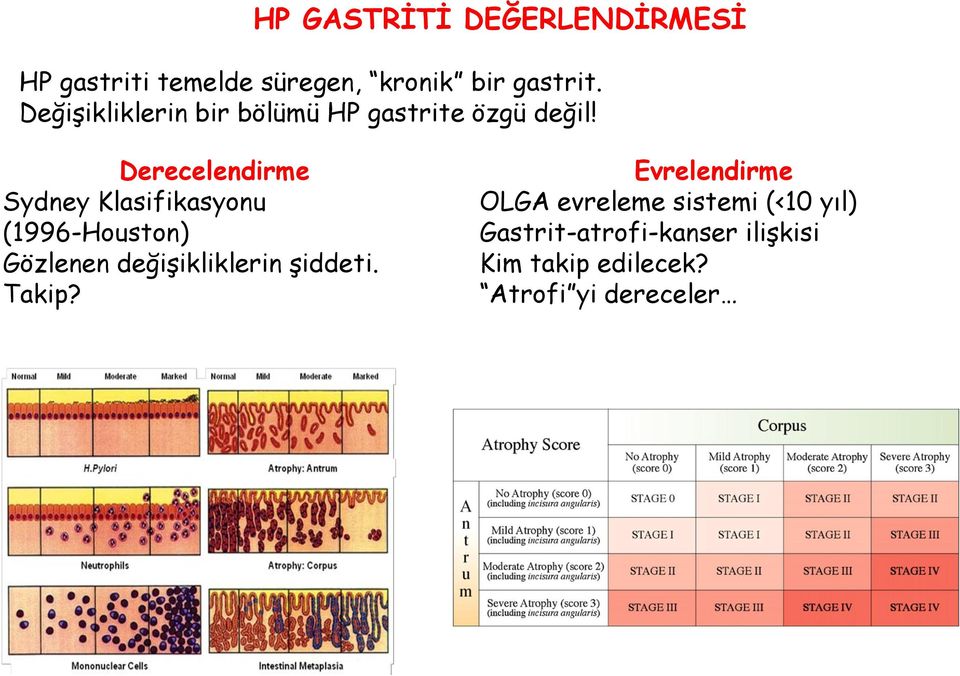 Derecelendirme Sydney Klasifikasyonu (1996-Houston) Gözlenen değişikliklerin