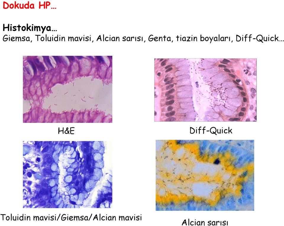 boyaları, Diff-Quick H&E Diff-Quick