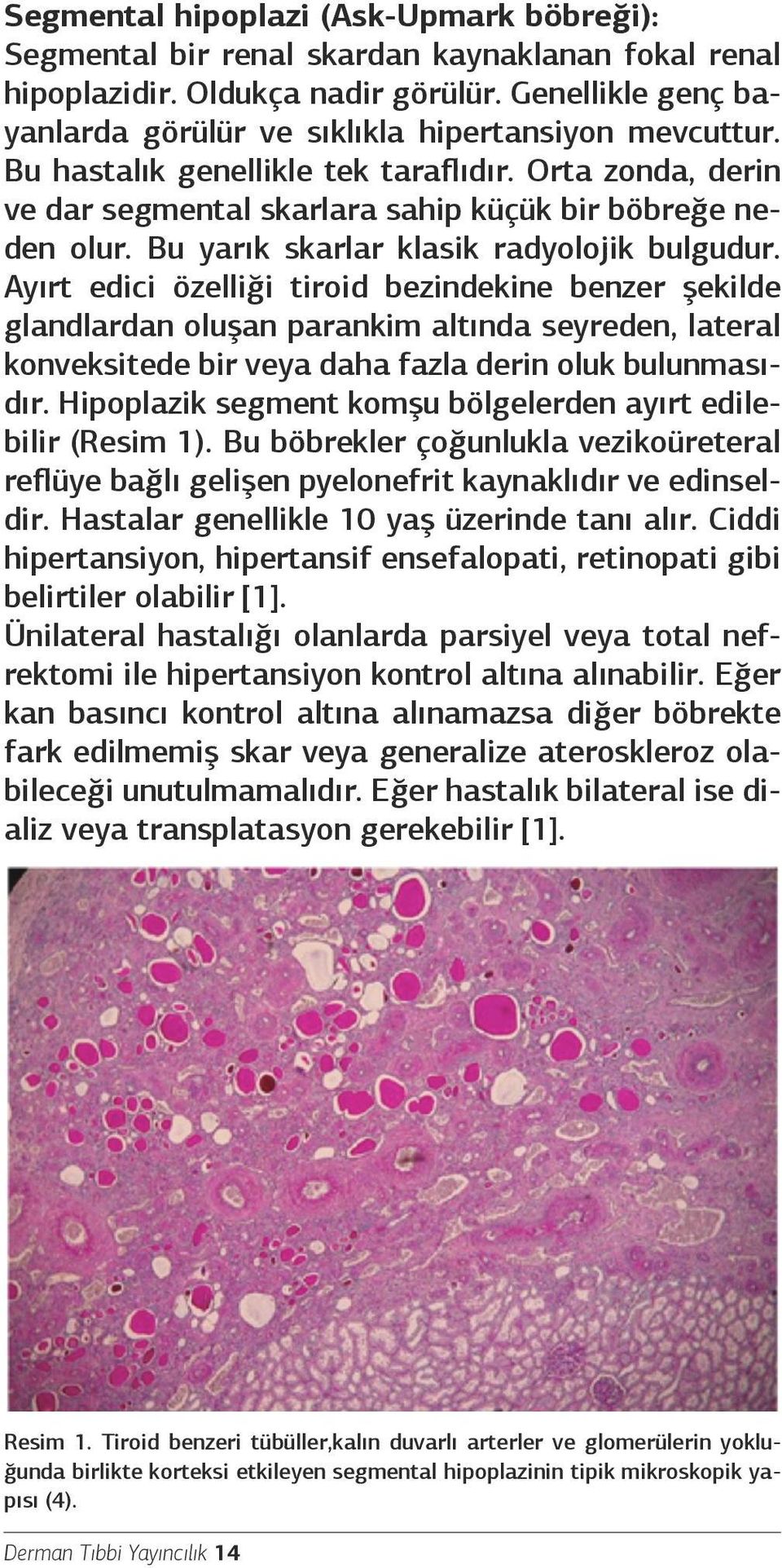 Bu yarık skarlar klasik radyolojik bulgudur.