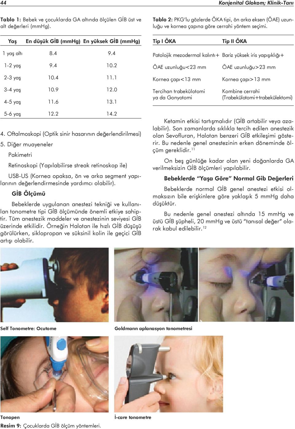 4 Patolojik mezodermal kalıntı+ Bariz yüksek iris yapışıklığı+ 1-2 yaş 9.4 10.2 2-3 yaş 10.4 11.1 3-4 yaş 10.9 12.0 4-5 yaş 11.6 13.