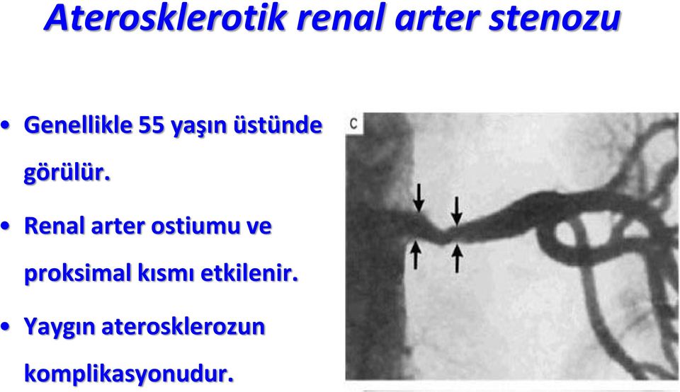 Renal arter ostiumu ve proksimal kısmı