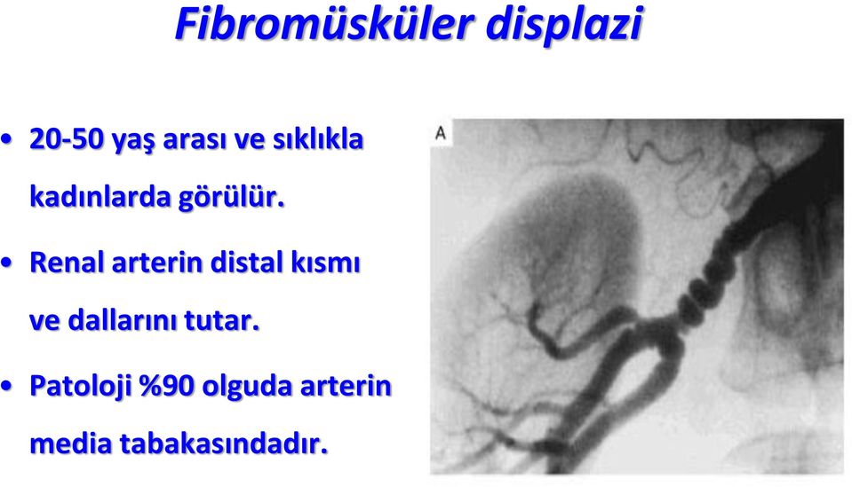 Renal arterin distal kısmı ve dallarını