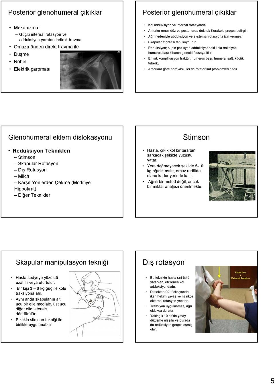 Reduksiyon; supin pozisyon adduksiyondaki kola traksiyon humerus başı kibarca glenoid fossaya itilir.