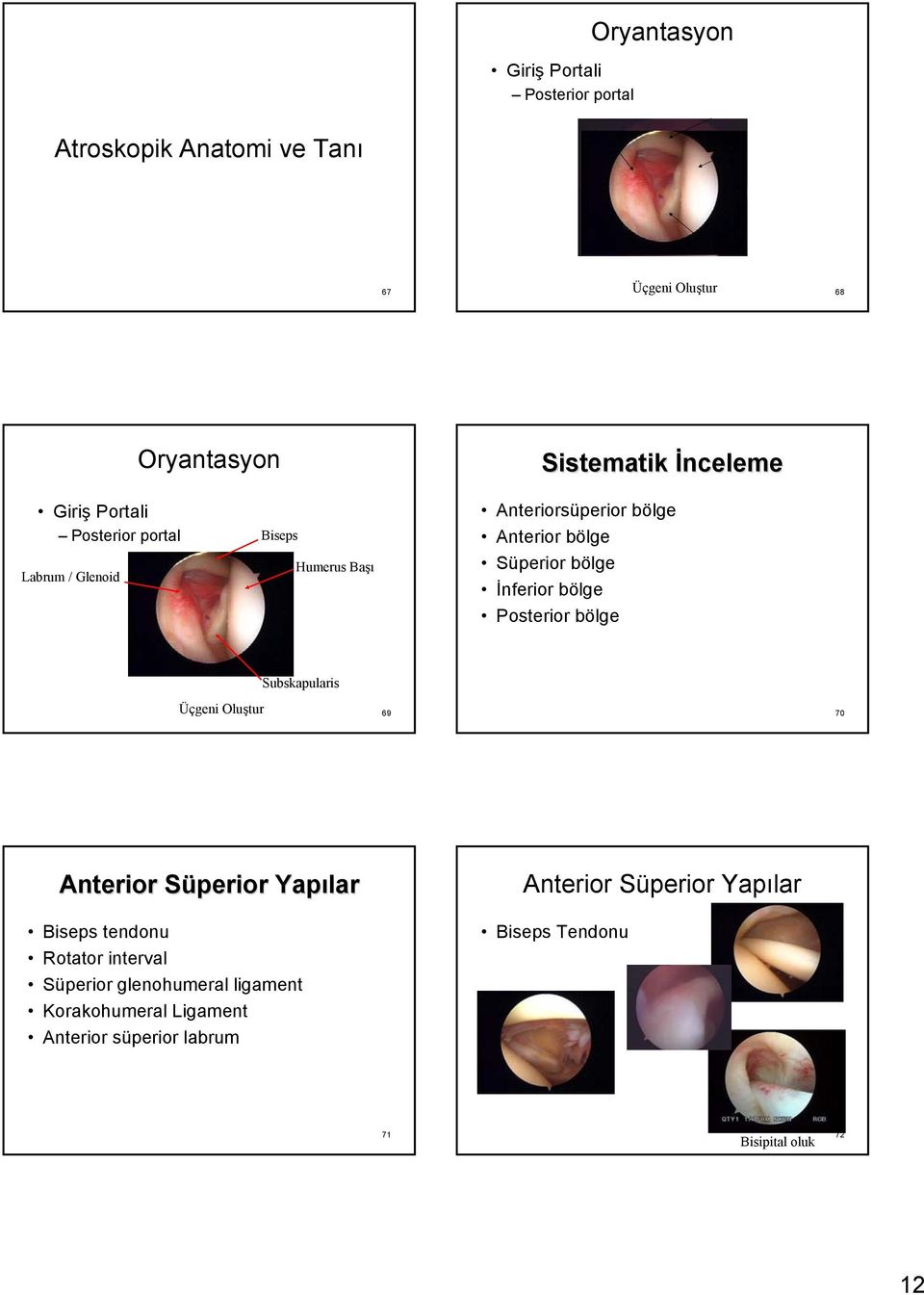 İnferior bölge Posterior bölge Subskapularis Üçgeni Oluştur 69 70 Anterior Süperior Yapılar Biseps tendonu Rotator interval