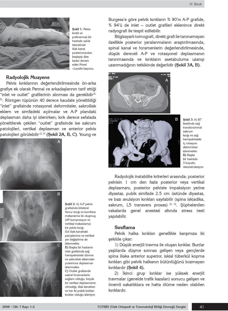 Bilgisayarlı tomografi, direkt grafi ile tanınamayan özellikle posterior yaralanmaların araştırılmasında, spinal kanal ve foramenlerin değerlendirilmesinde, düşük dereceli A-P ve rotasyonel
