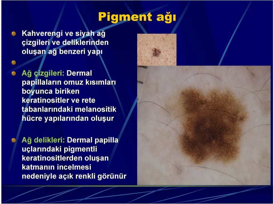 tabanlarındaki melanositik hücre yapılarından oluşur Ağ delikleri: Dermal papilla