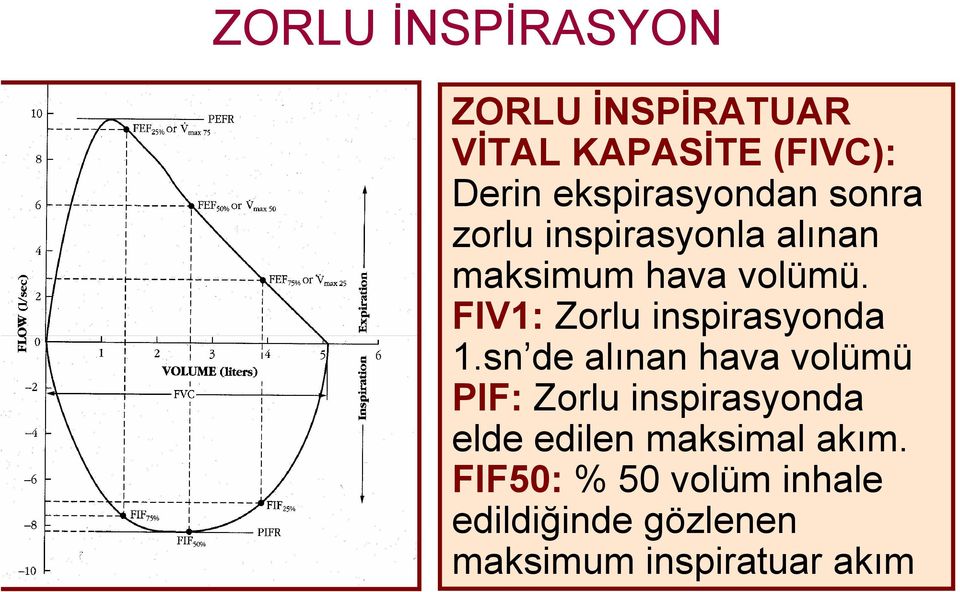 FIV1: Zorlu inspirasyonda 1.