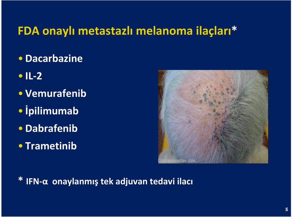 Vemurafenib İpilimumab Dabrafenib