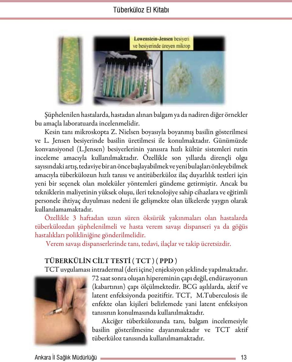 Özellikle son yıllarda dirençli olgu sayısındaki artış, tedaviye bir an önce başlayabilmek ve yeni bulaşları önleyebilmek amacıyla tüberkülozun hızlı tanısı ve antitüberküloz ilaç duyarlılık testleri