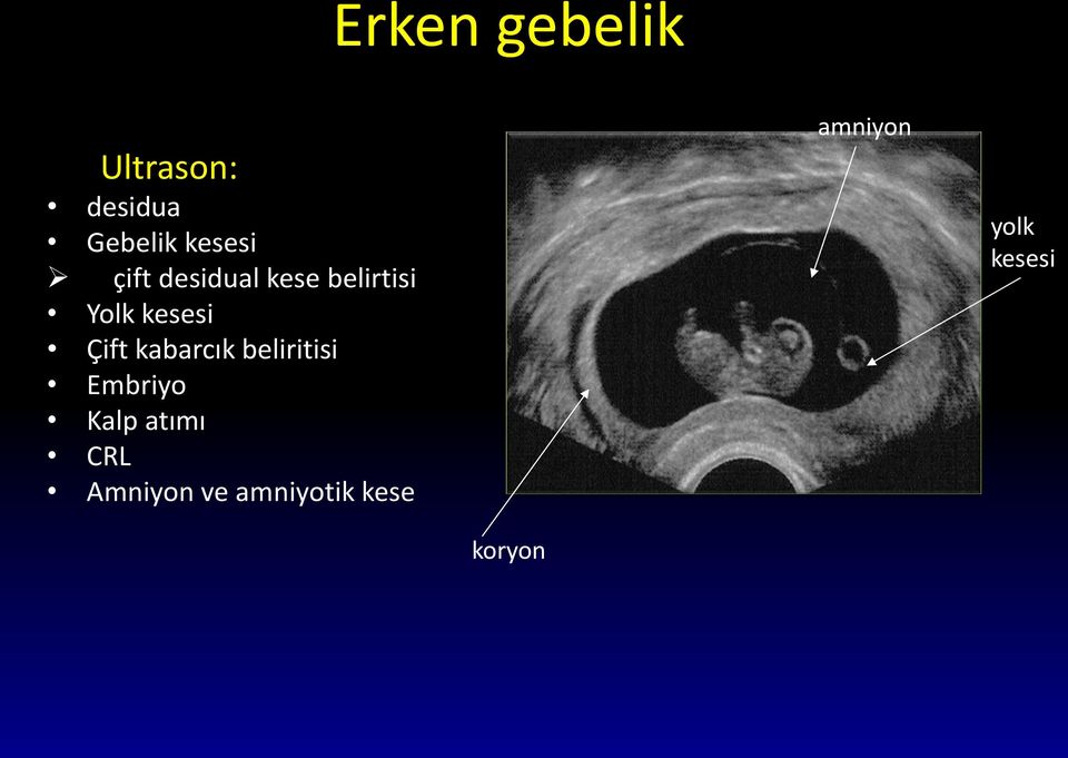 kabarcık beliritisi Embriyo Kalp atımı CRL