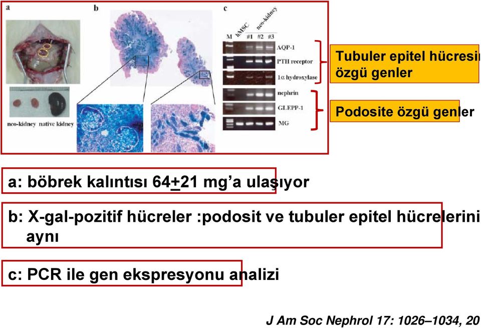 hücreler :podosit ve tubuler epitel hücrelerini aynı c: PCR