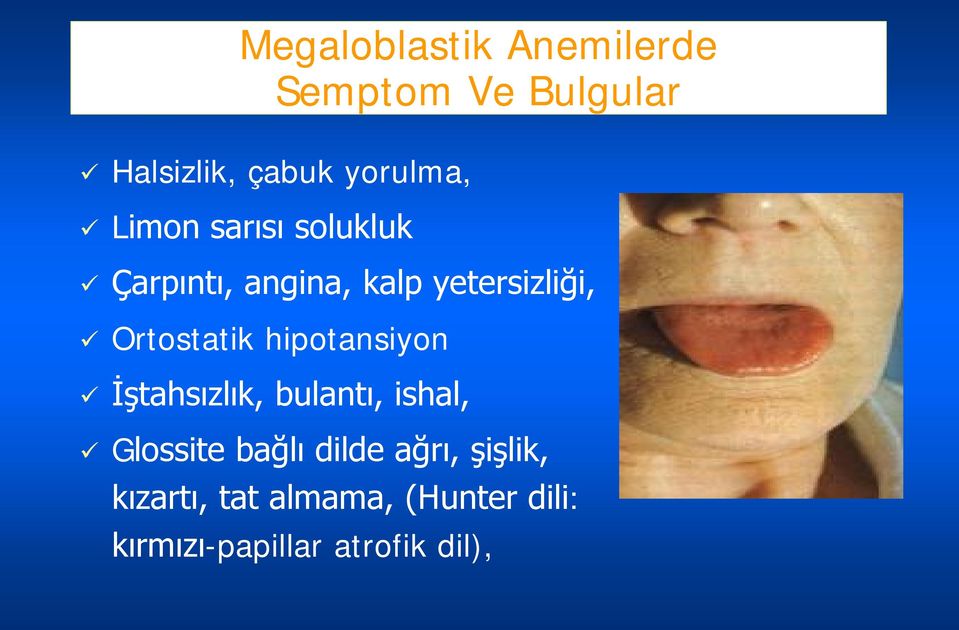 hipotansiyon İştahsızlık, bulantı, ishal, Glossite bağlı dilde ağrı,