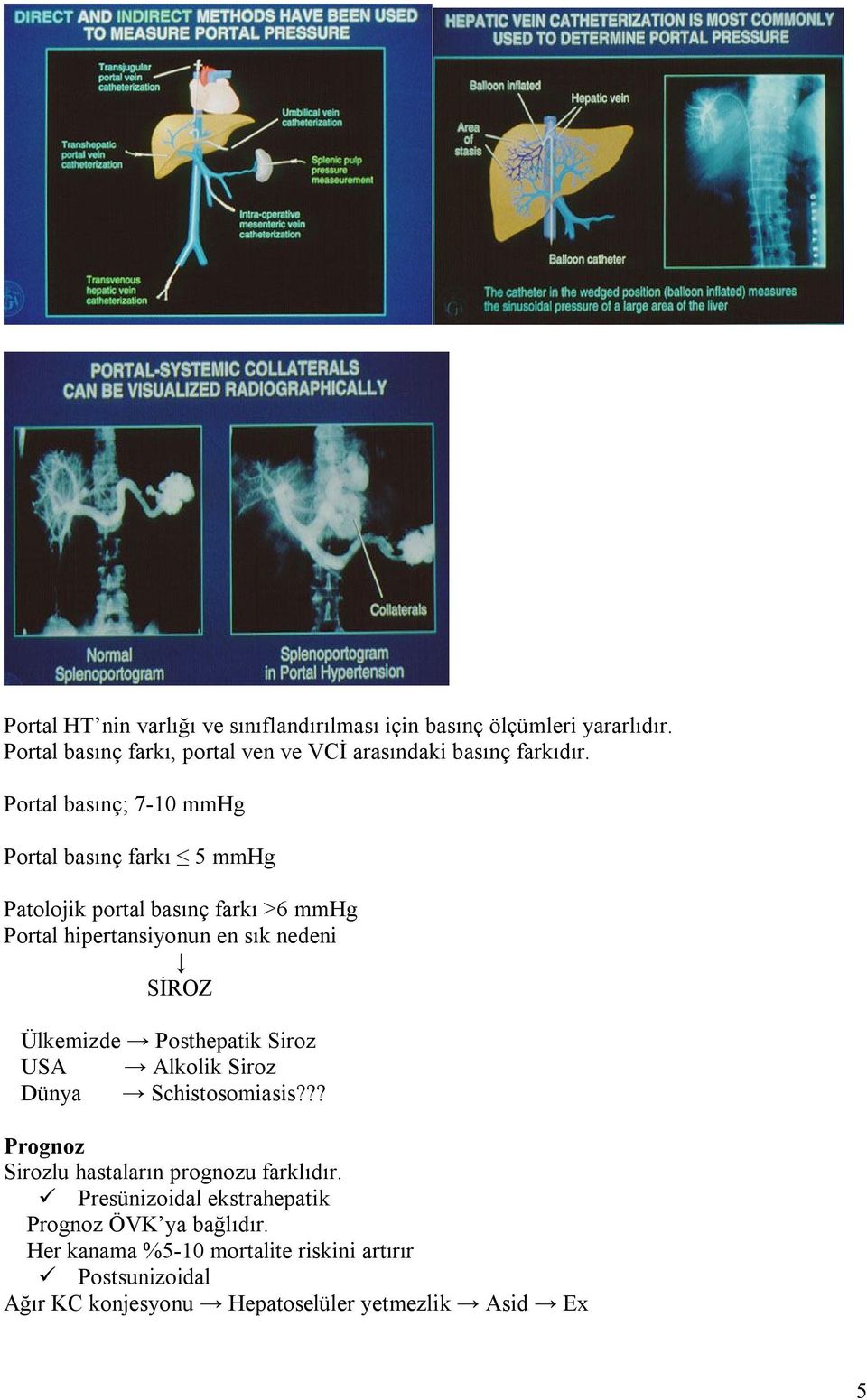 Portal basınç; 7-10 mmhg Portal basınç farkı 5 mmhg Patolojik portal basınç farkı >6 mmhg Portal hipertansiyonun en sık nedeni SİROZ