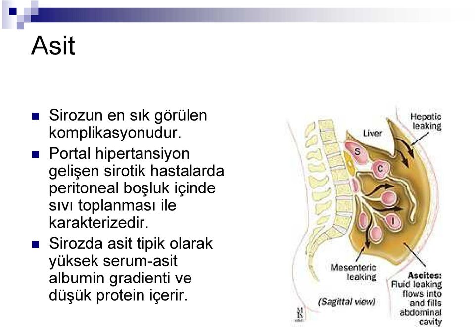 boşluk içinde sıvı toplanması ile karakterizedir.