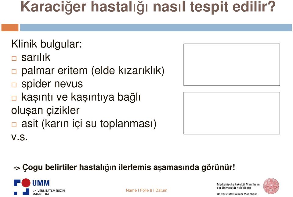 nevus kaşıntı ve kaşıntıya bağlı oluşan çizikler asit (karın içi su