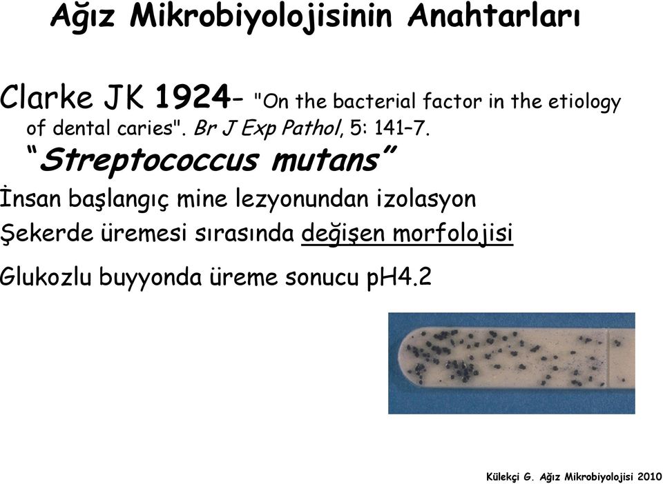 Streptococcus mutans İnsan başlangıç mine lezyonundan izolasyon Şekerde