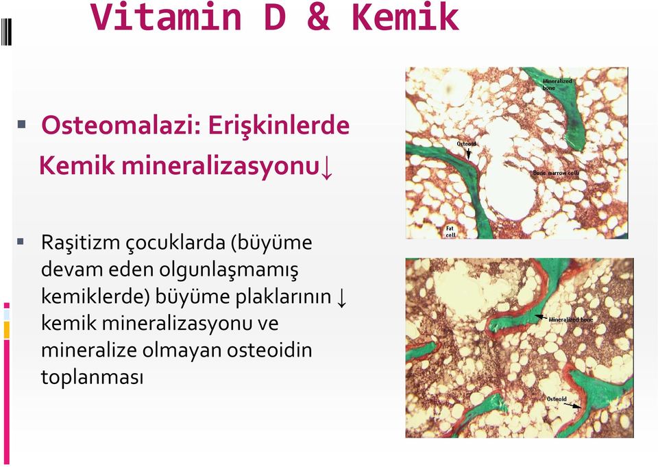 eden olgunlaşmamış kemiklerde) büyüme plaklarının