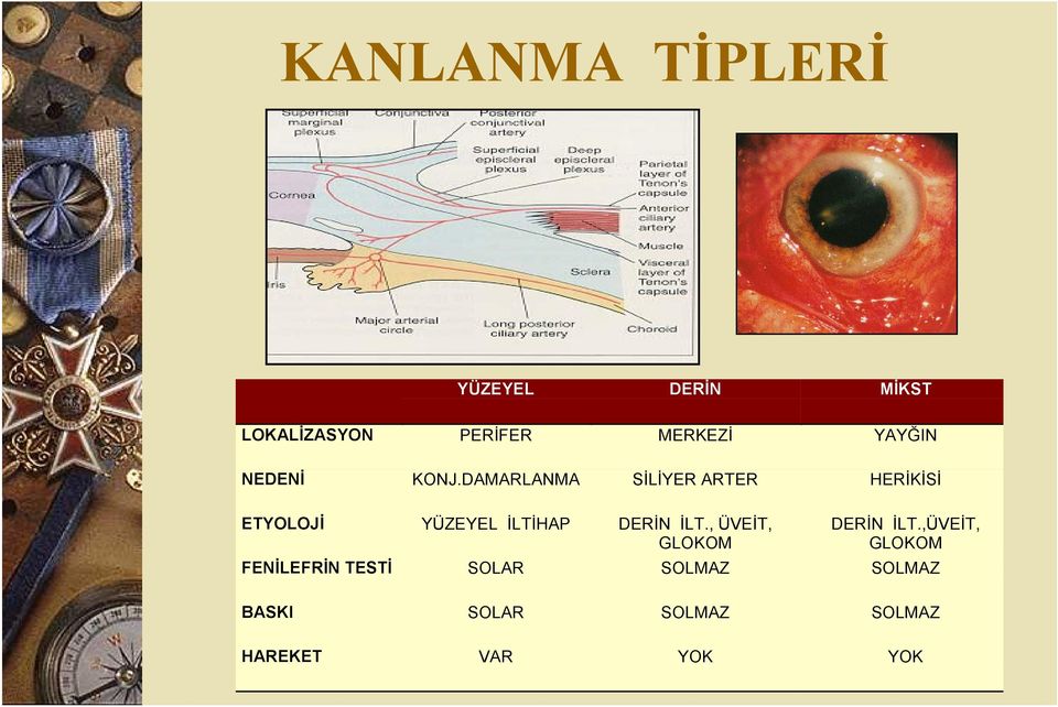 DAMARLANMA SİLİYER ARTER HERİKİSİ ETYOLOJİ YÜZEYEL İLTİHAP DERİN İLT.