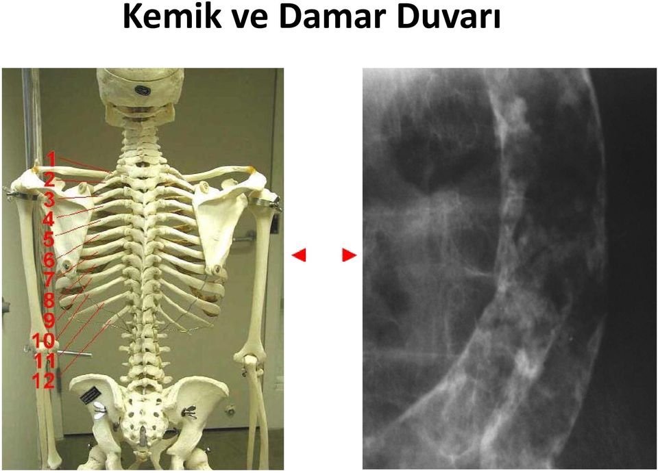 Duvarı