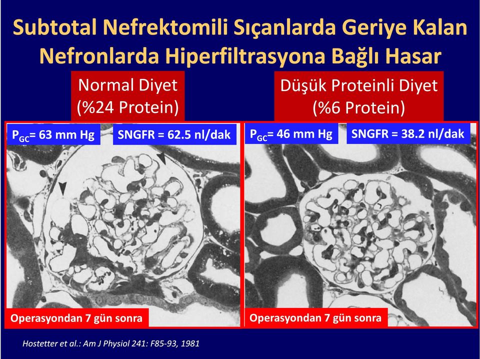 mm Hg SNGFR = 62.5 nl/dak P GC = 46 mm Hg SNGFR = 38.