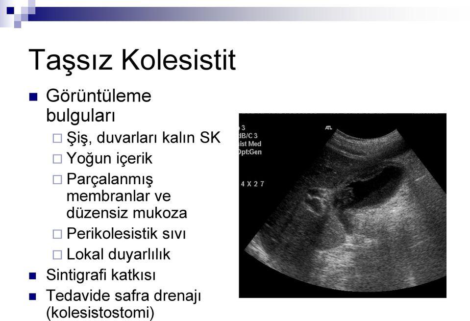 membranlar ve düzensiz mukoza Perikolesistik sıvı