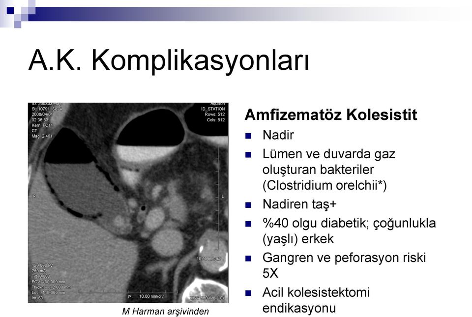 (Clostridium orelchii*) Nadiren taş+ %40 olgu diabetik;