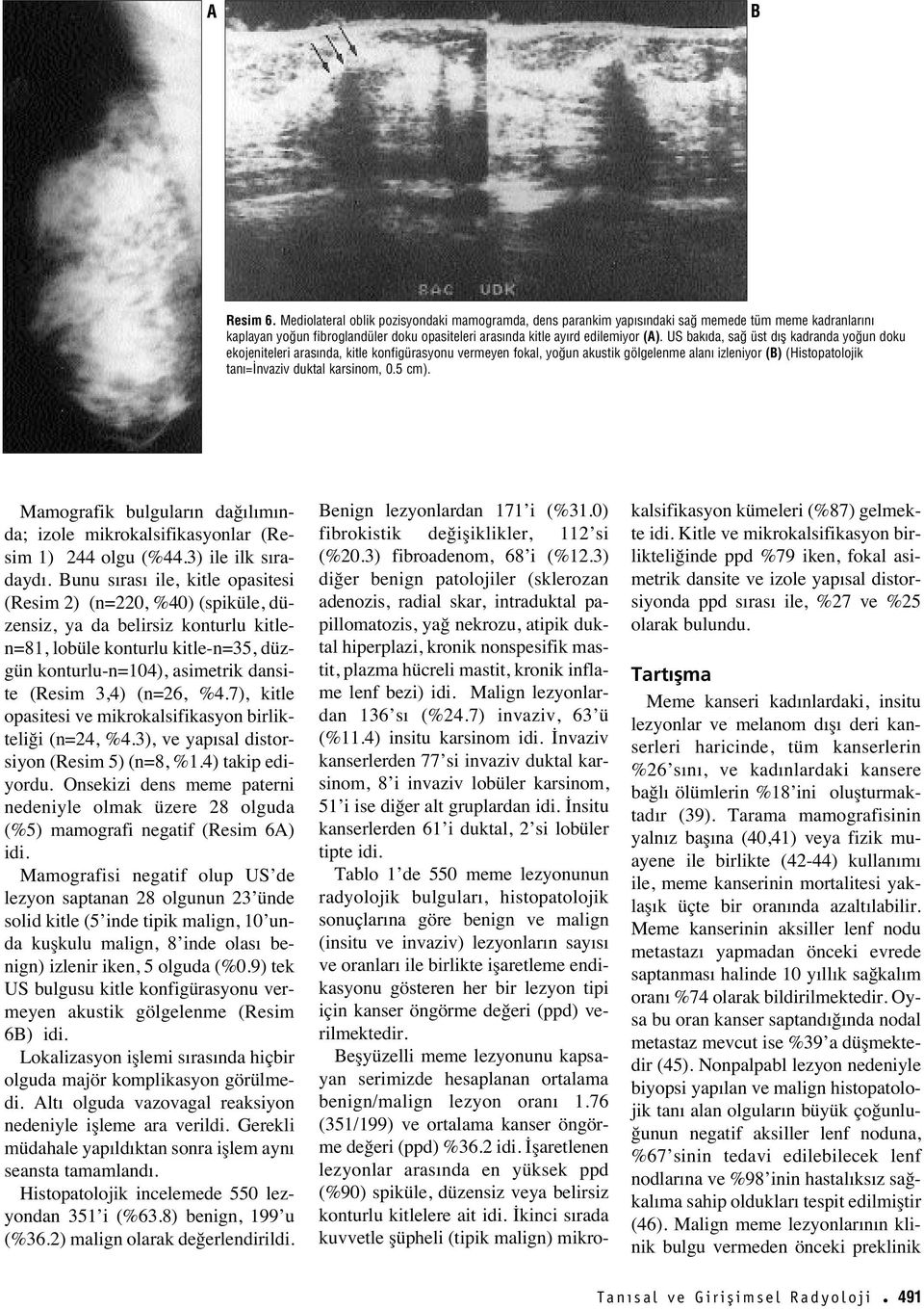 5 cm). Mamografik bulgular n dağ l m nda; izole mikrokalsifikasyonlar (Resim 1) 244 olgu (%44.3) ile ilk s radayd.