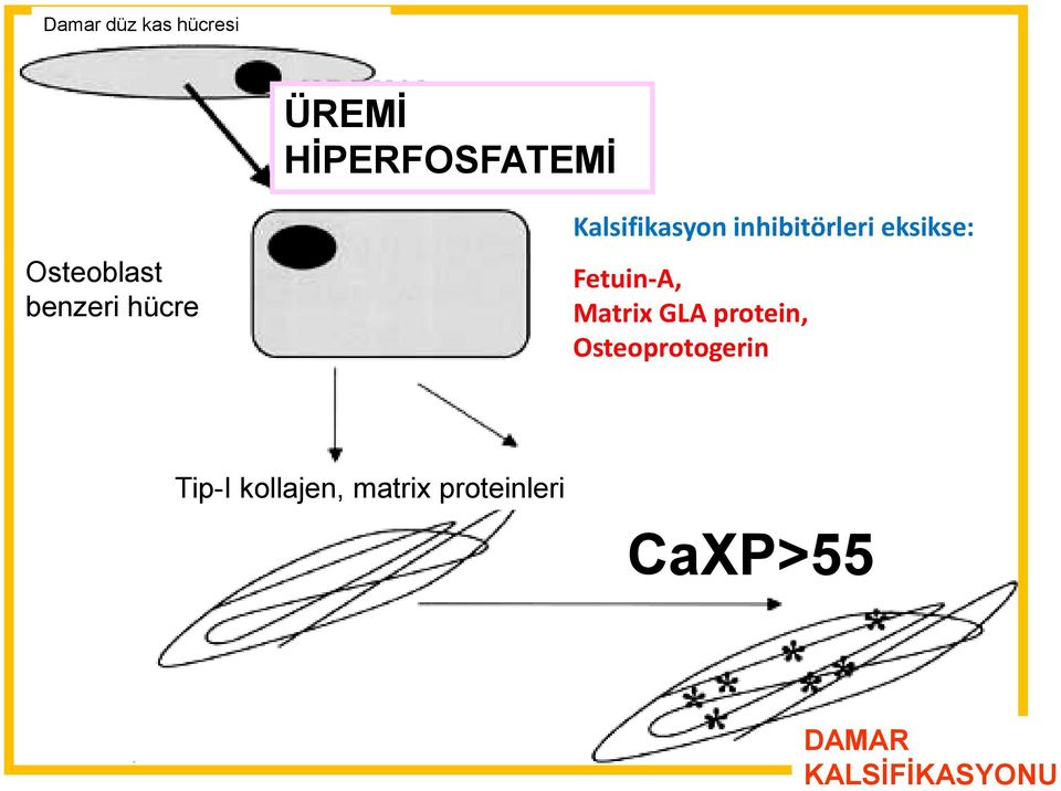 Fetuin-A, Matrix GLA protein, Osteoprotogerin Tip-I