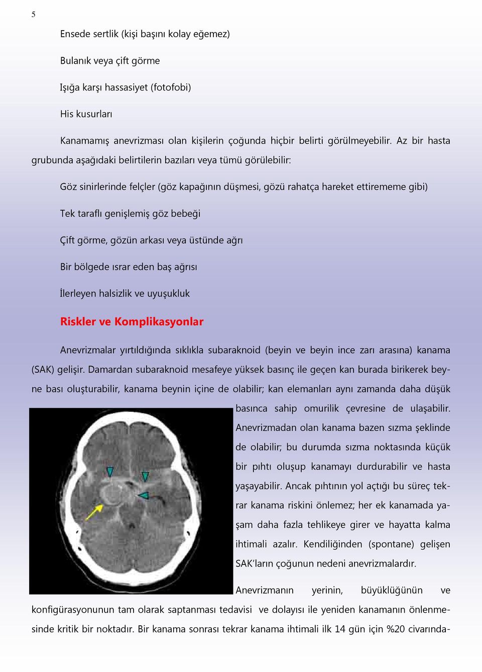 Çift görme, gözün arkası veya üstünde ağrı Bir bölgede ısrar eden baş ağrısı İlerleyen halsizlik ve uyuşukluk Riskler ve Komplikasyonlar Anevrizmalar yırtıldığında sıklıkla subaraknoid (beyin ve