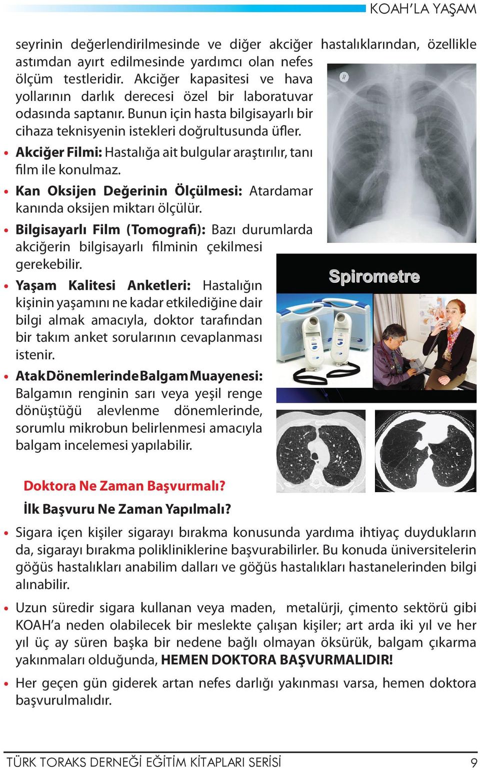 Akciğer Filmi: Hastalığa ait bulgular araştırılır, tanı film ile konulmaz. Kan Oksijen Değerinin Ölçülmesi: Atardamar kanında oksijen miktarı ölçülür.