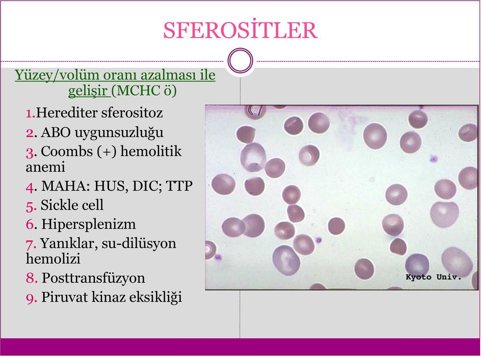 Coombs (+) hemolitik anemi 4. MAHA: HUS, DIC; TTP 5. Sickle cell 6.