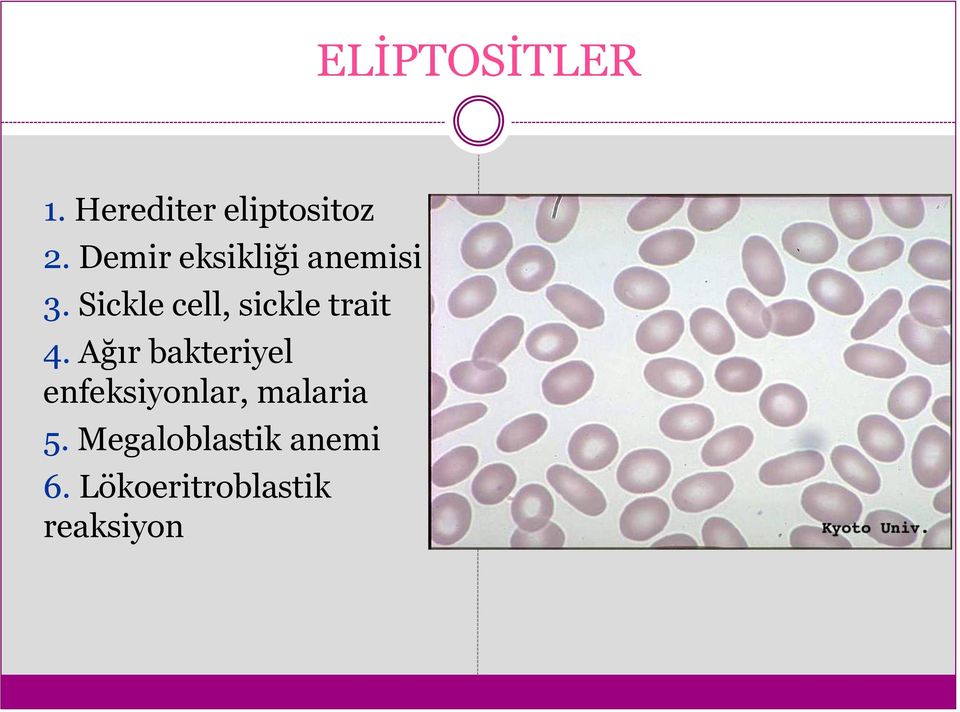 Sickle cell, sickle trait 4.