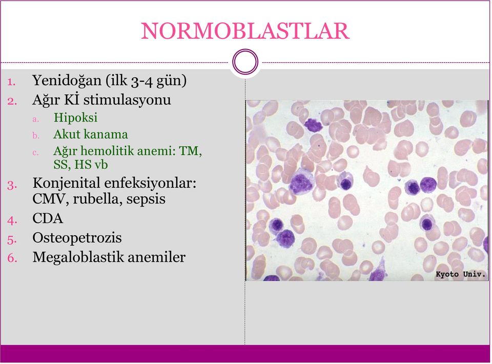Ağır hemolitik anemi: TM, SS, HS vb 3.