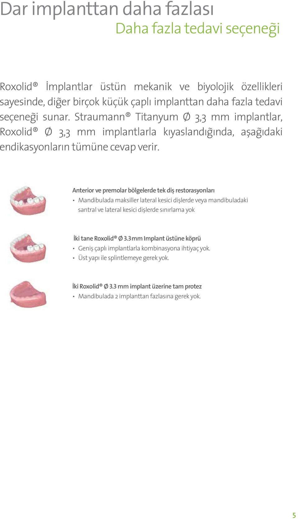 Anterior ve premolar bölgelerde tek diş restorasyonları Mandibulada maksiller lateral kesici dişlerde veya mandibuladaki santral ve lateral kesici dişlerde sınırlama yok İki tane