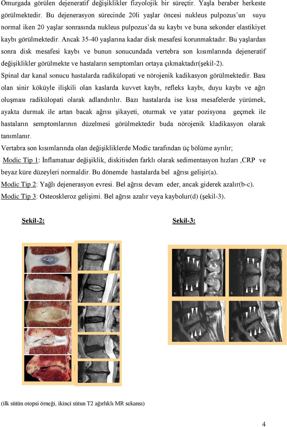 Ancak 35-40 yaşlarına kadar disk mesafesi korunmaktadır.