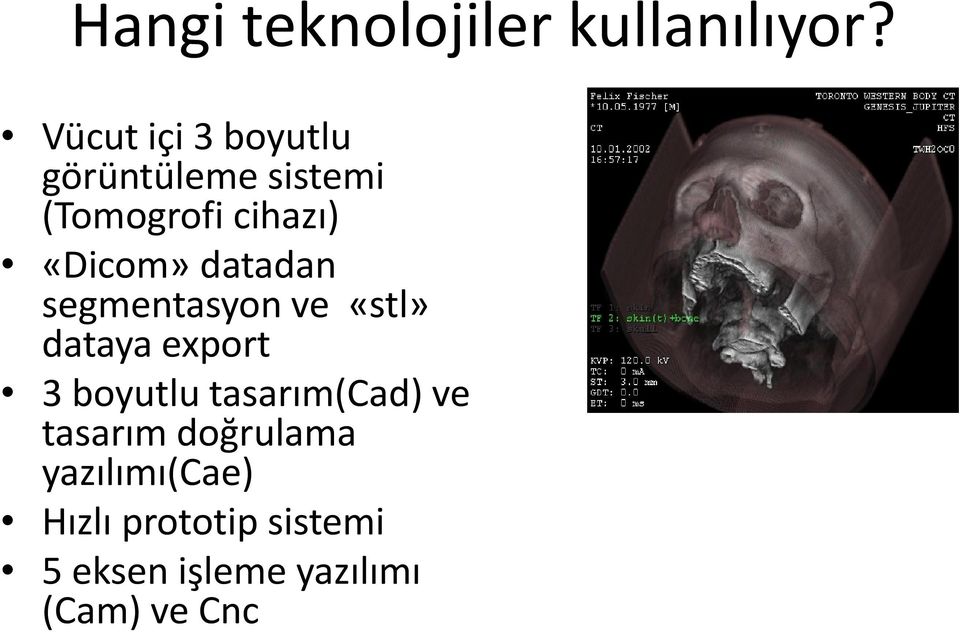 «Dicom» datadan segmentasyon ve «stl» dataya export 3 boyutlu