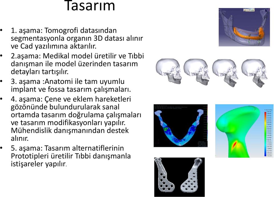 aşama :Anatomi ile tam uyumlu implant ve fossa tasarım çalışmaları. 4.